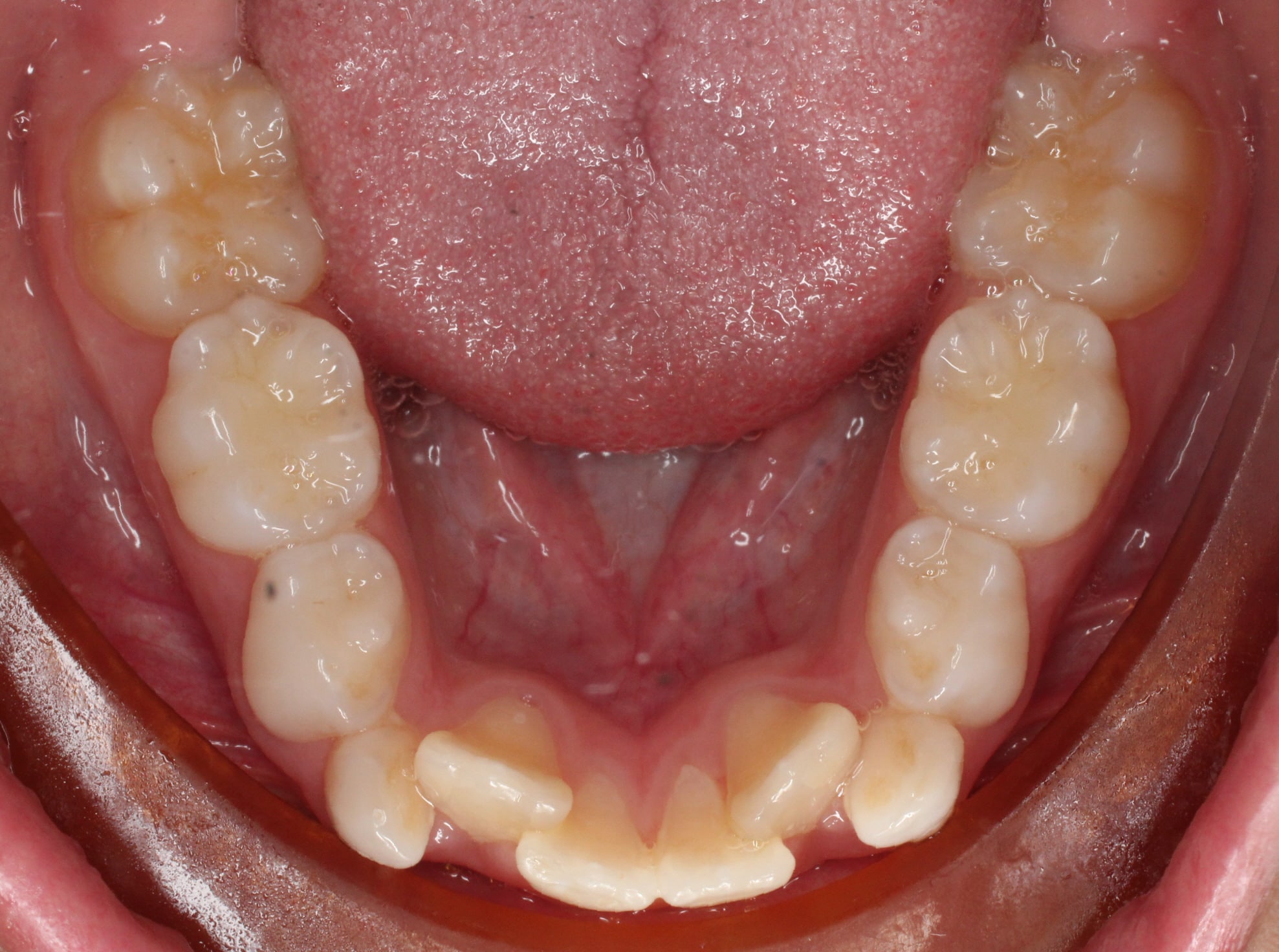 Dr. Doug Orthodontics In Rockville Centre, NY