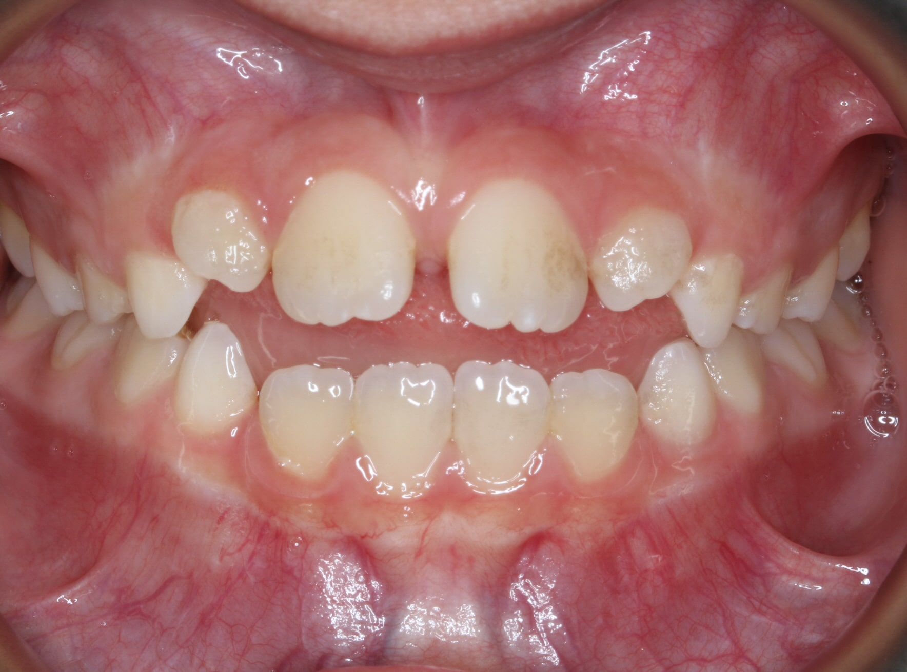 Dr. Doug Orthodontics In Rockville Centre, NY