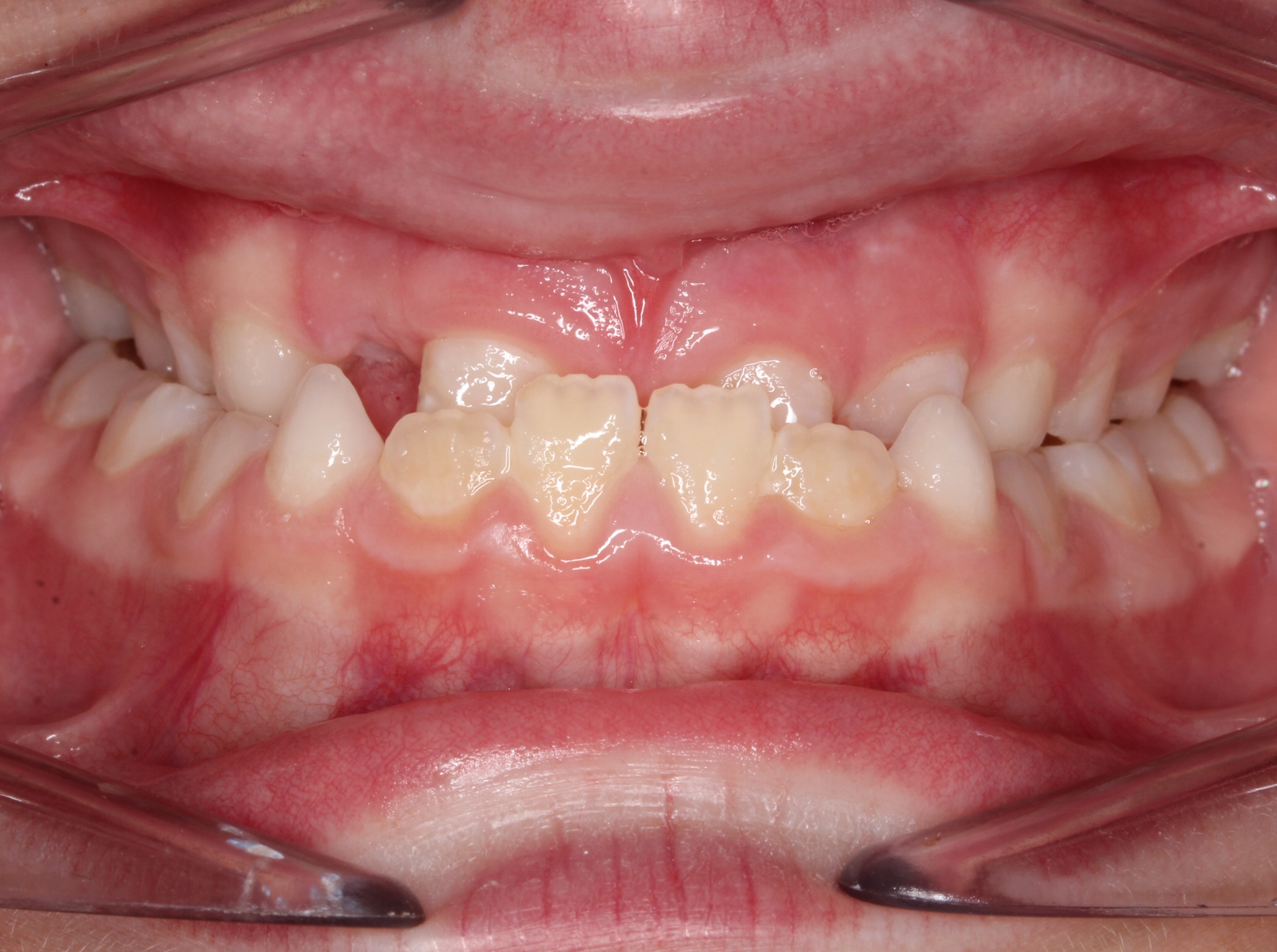 Dr. Doug Orthodontics In Rockville Centre, NY